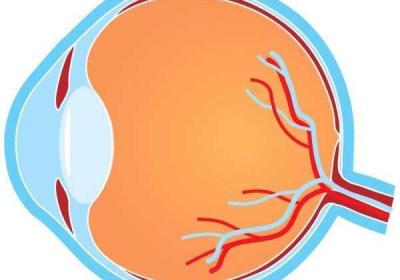 泰拉瑞亚 泰拉瑞亚灾厄