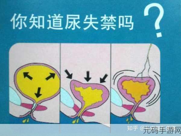 戴上尿锁不能尿知乎，1. 尿锁的背后：为何它会成为一种选择？